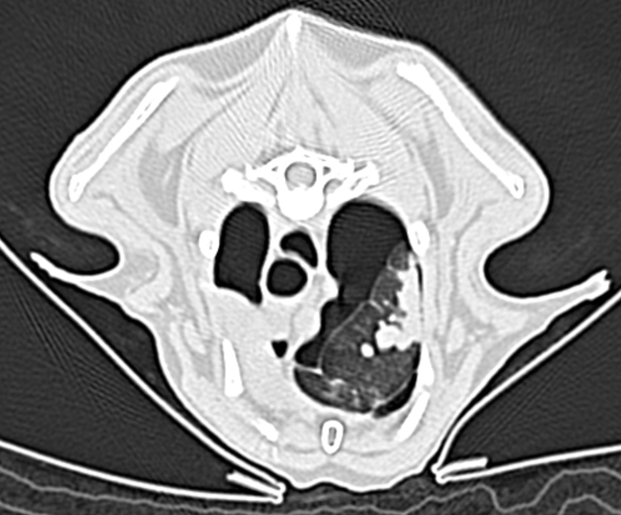 Feline Thorax — Pneumothorax secondary to suspected ruptured pleural blebs and collapsed right middle lung lobe due to bronchial mucus/purulent material plugging secondary to chronic inflammatory airway disease (feline asthma)