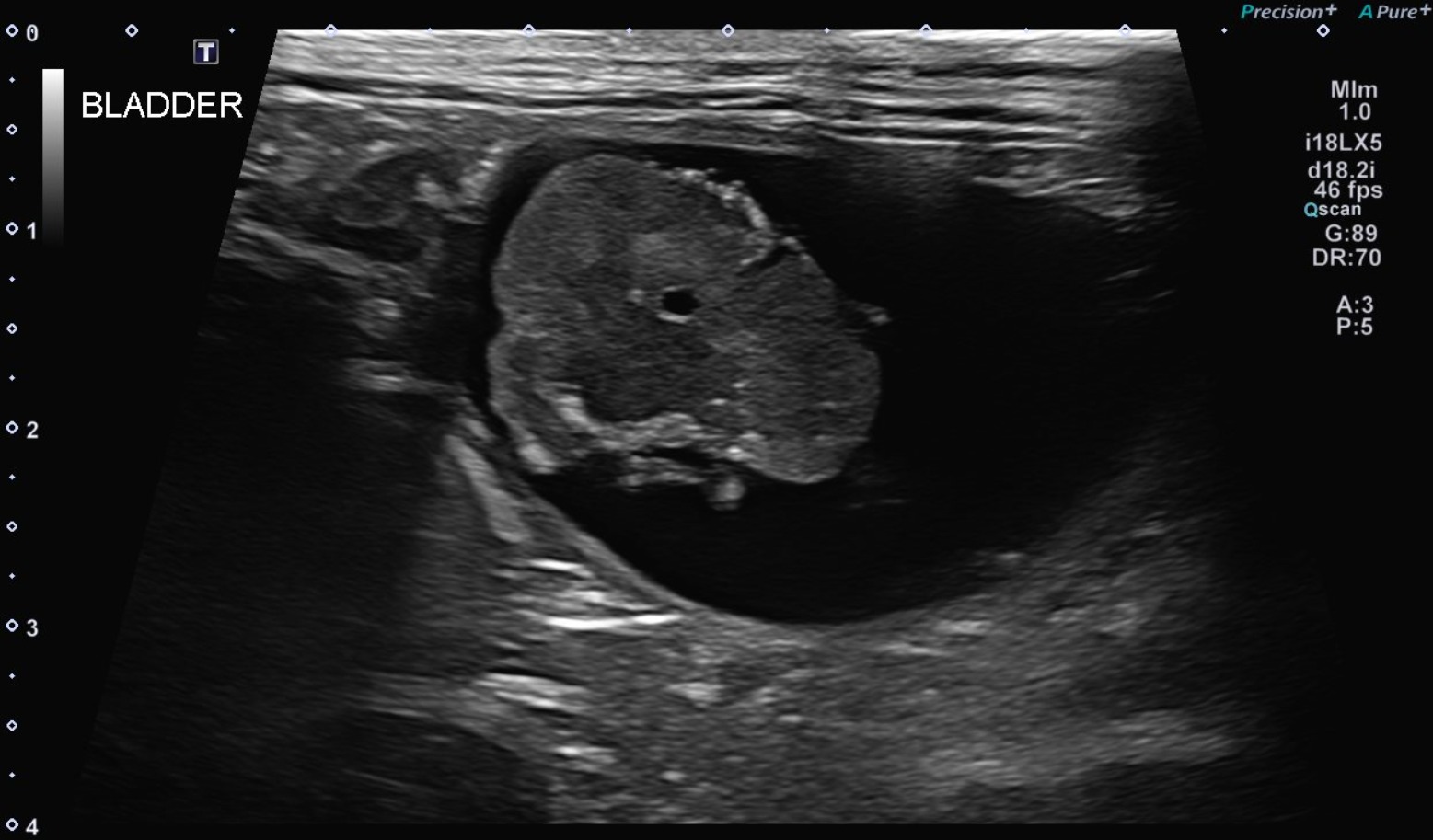 Feline Abdomen — Urothelial carcinoma (transitional cell carcinoma)
