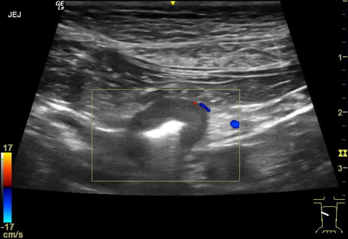 Canine Abdomen — Small intestinal lymphoma, large-cell