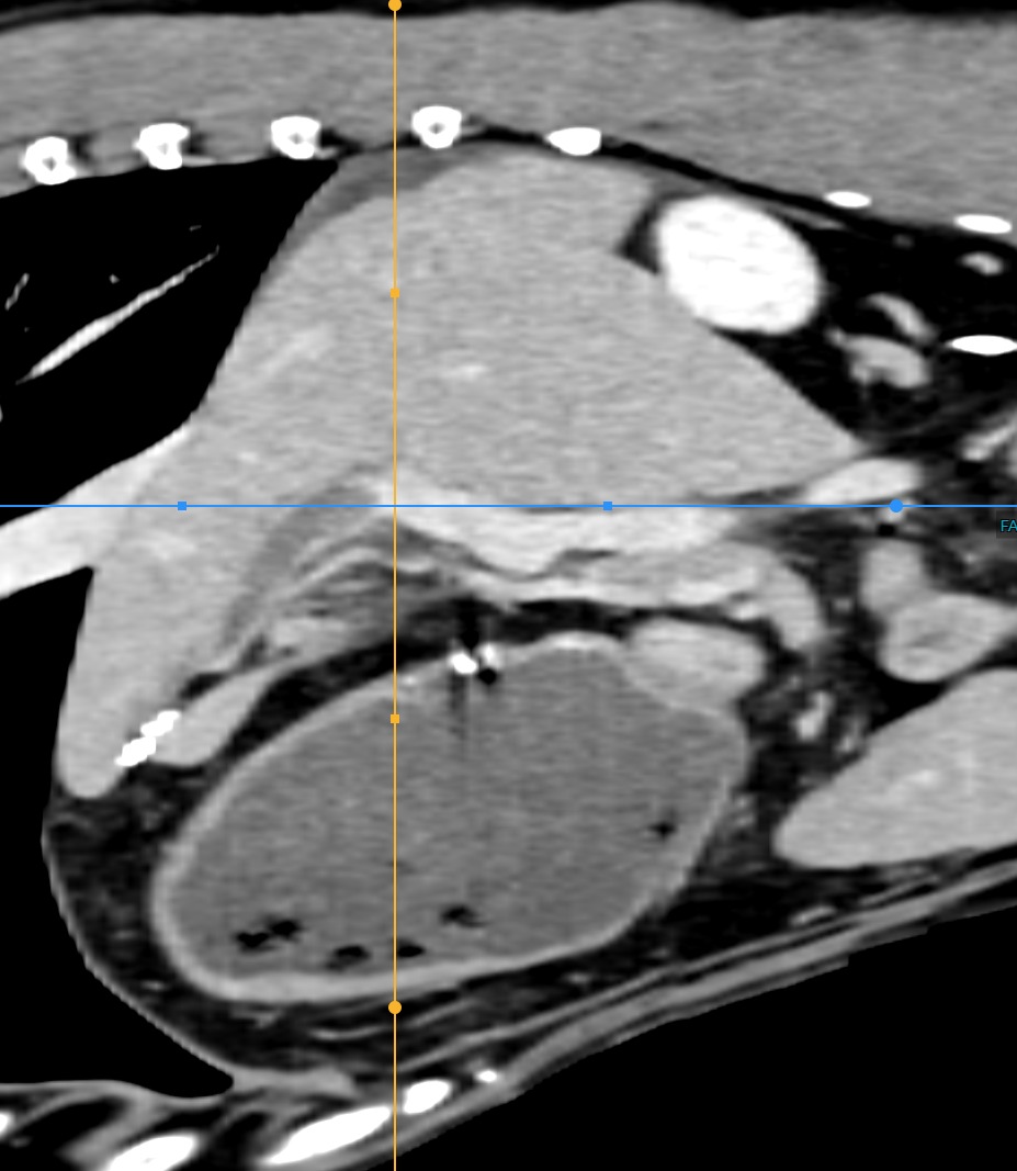 Canine Abdomen — Portal vein thrombus