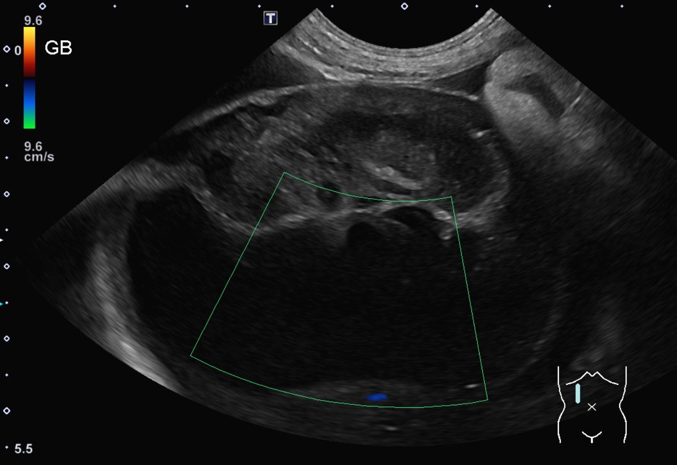Canine Abdomen — Gallbladder mucocele