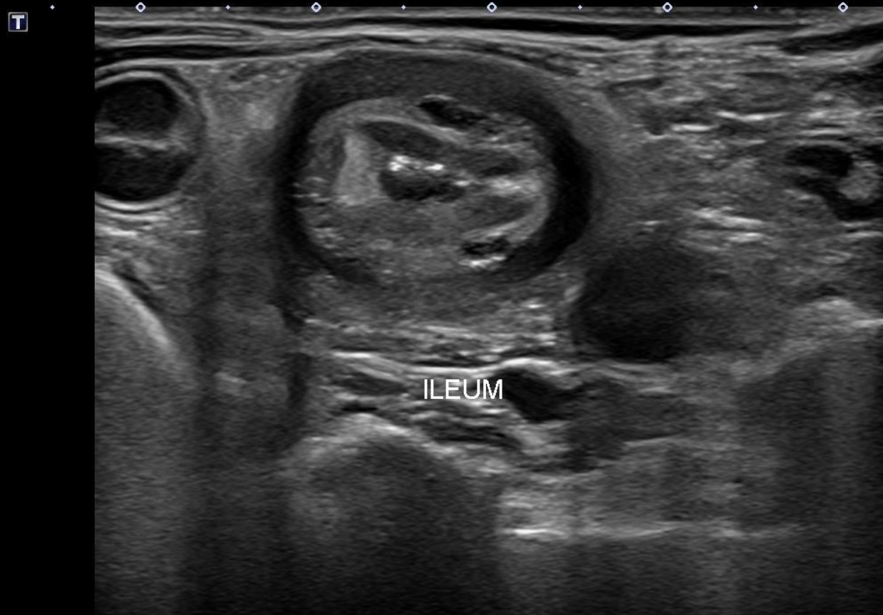 Canine Abdomen — Lipogranulomatous lymphangitis