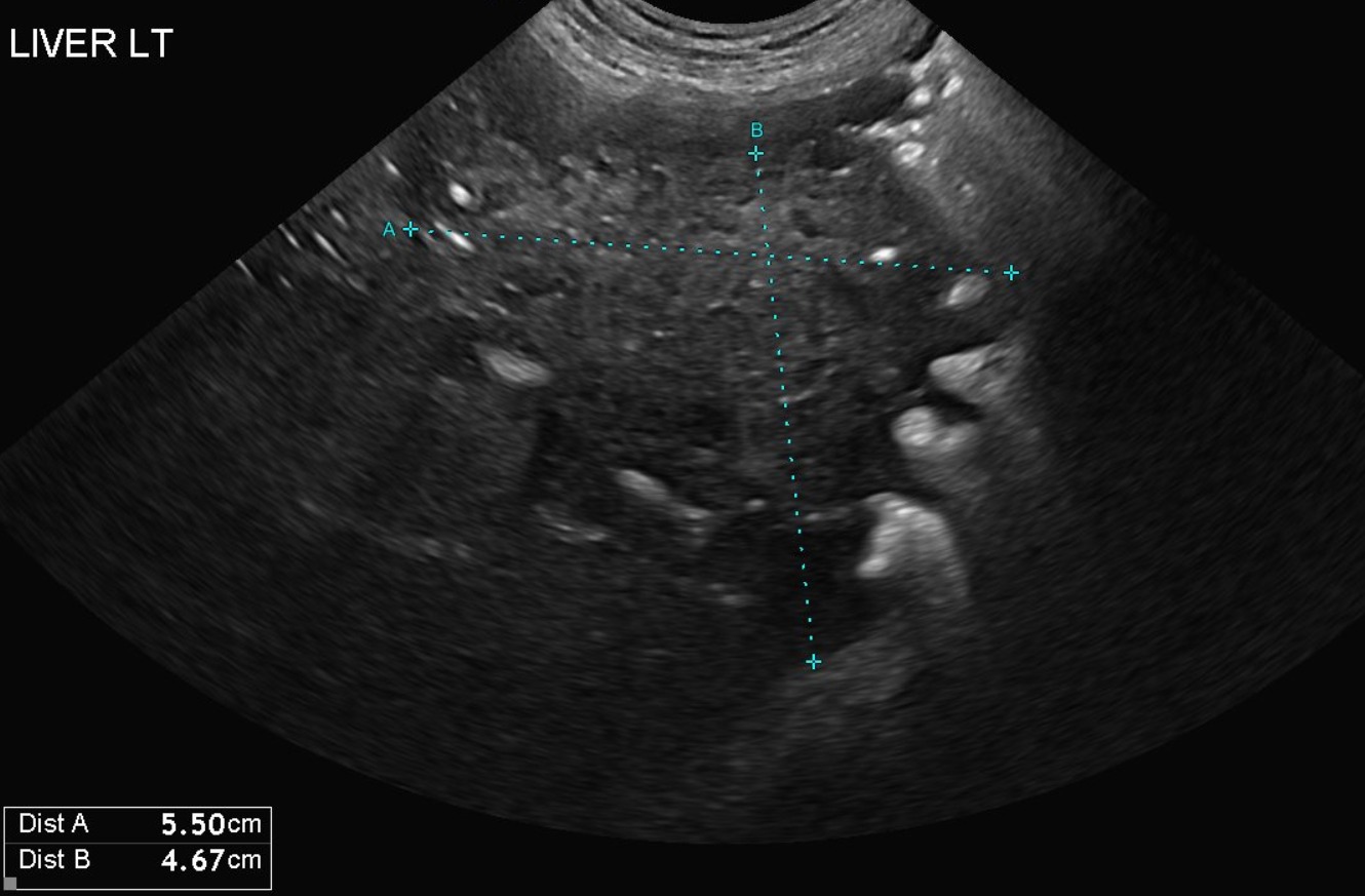 Canine Abdomen — Hepatic abscesses