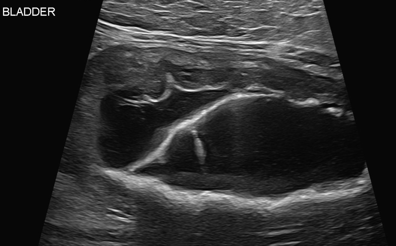 Feline Abdomen — Pseudomembranous cystitis